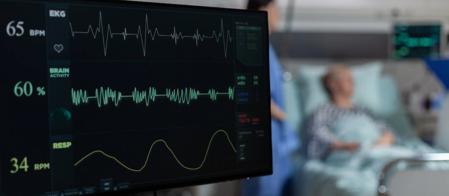 Echocardiography