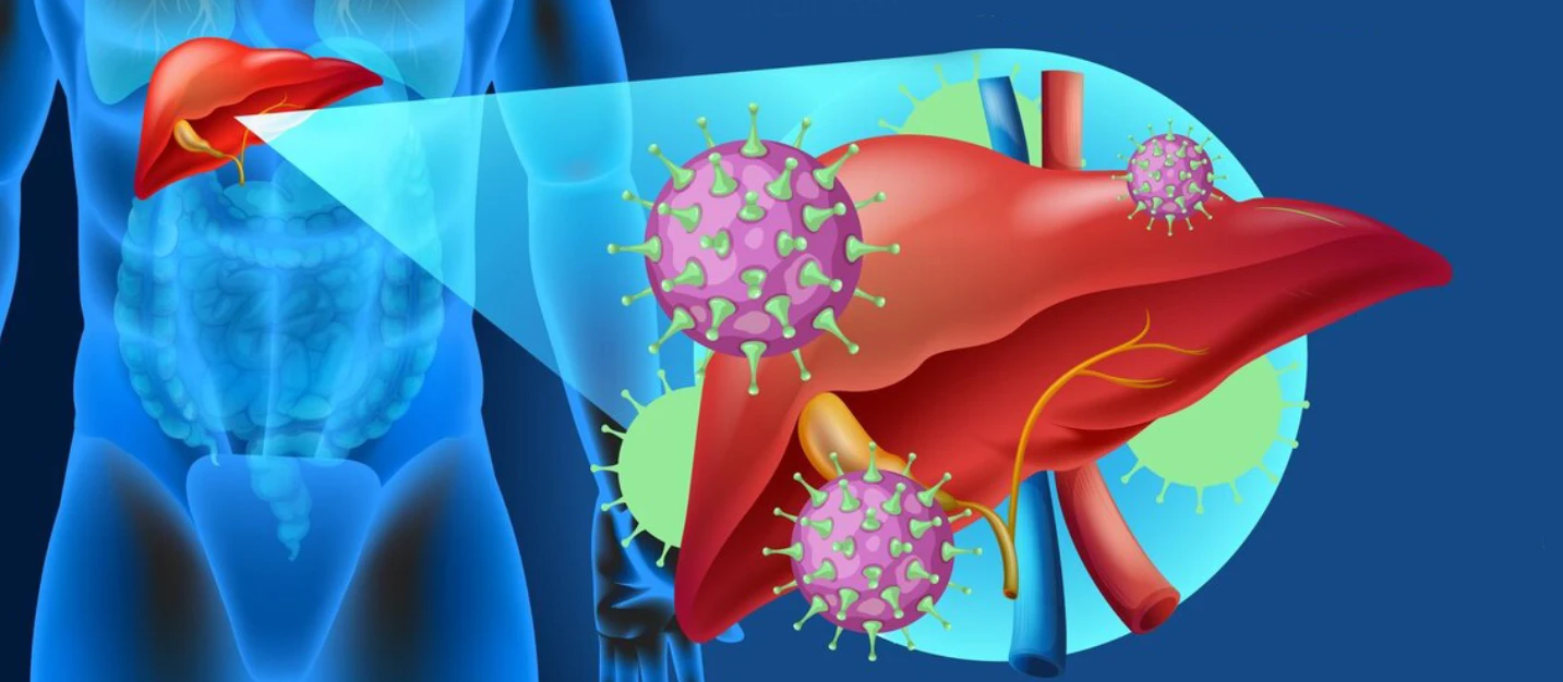 Acute Liver Failure